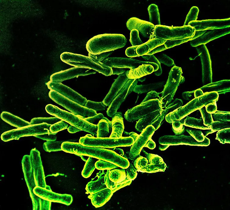 Imagem de microscopia de bactérias da tuberculose em forma de bastonete coradas de verde