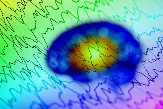 data waves superimposed on colourful brain image
