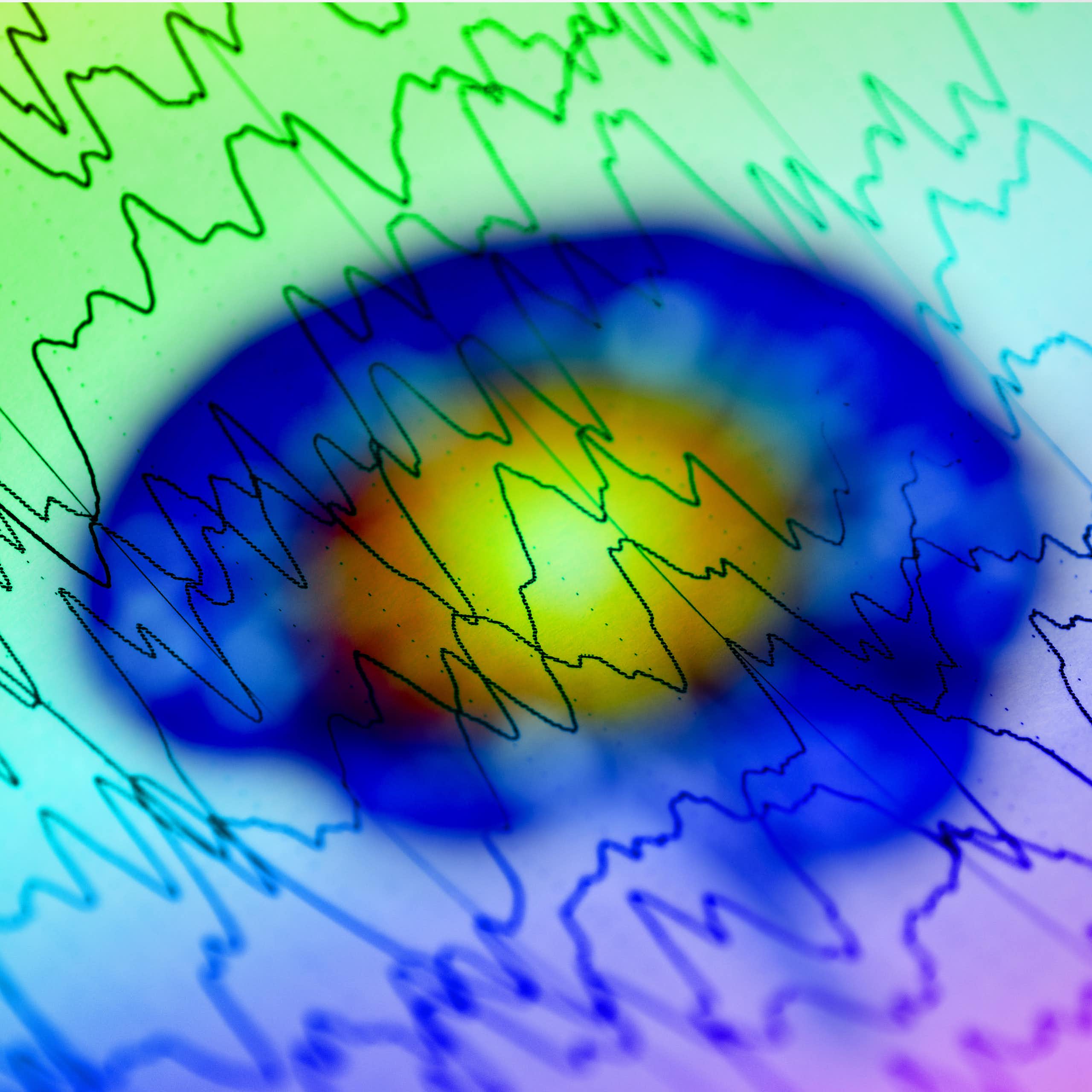 data waves superimposed on colourful brain image