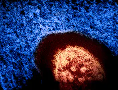 microscopic image of a virus
