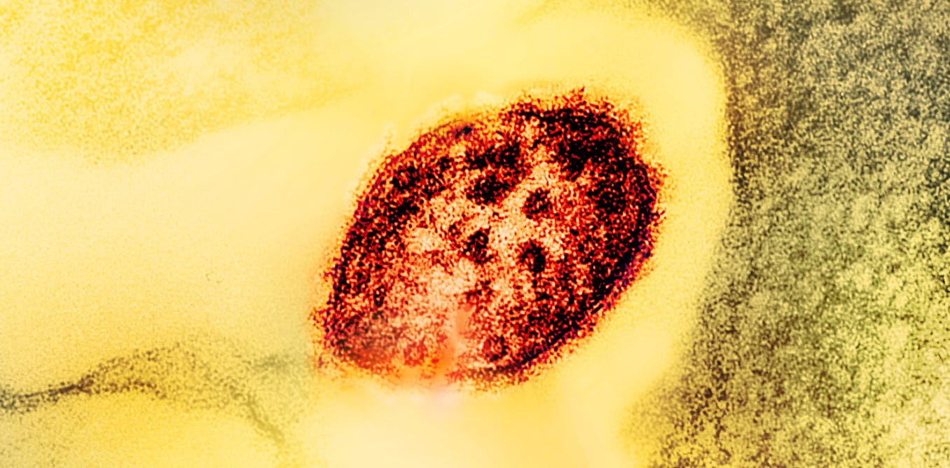 Measles is highly contagious, but vaccinepreventable A primer on