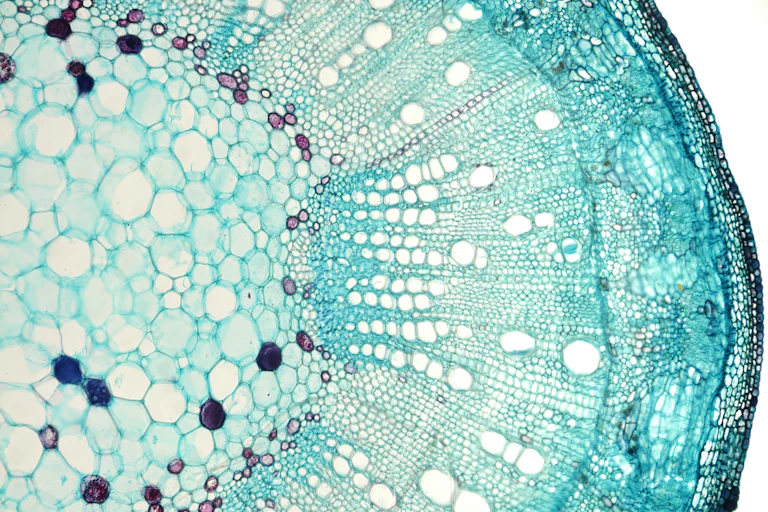 A microscopic image of a cross-section of a plant stem, showing cell and other structures.