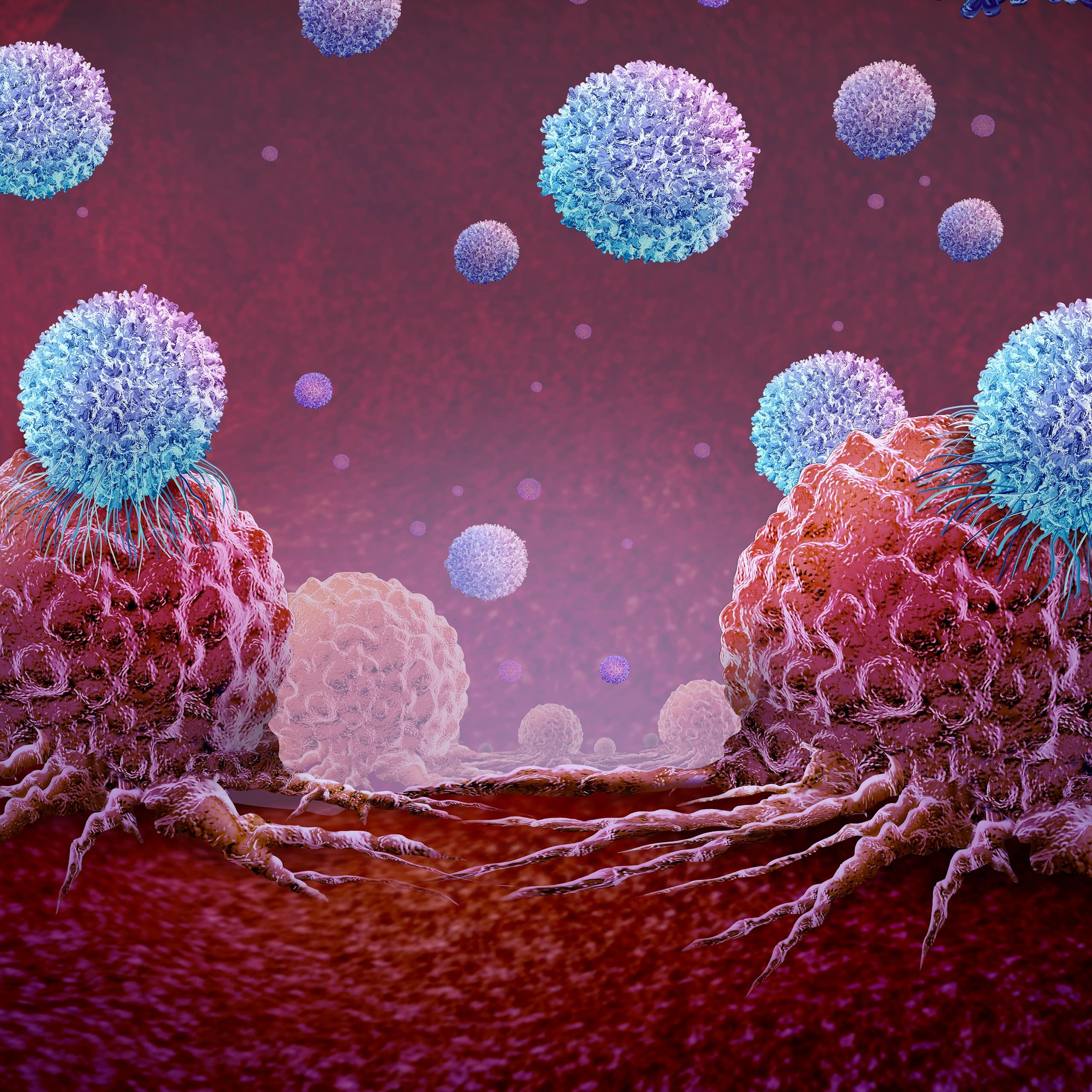 Inmunoterapia celular con linfocitos infiltrantes de tumor: ya podemos despertar al sistema inmunitario para que aniquile el cáncer
