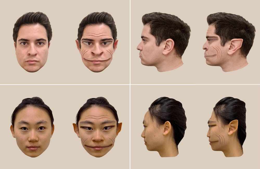 A rare condition makes other people’s faces look distorted. Why a new ...