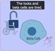 Example of a lock and beta cell