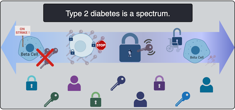 Illustration of different subtypes of Type 2 diabetes
