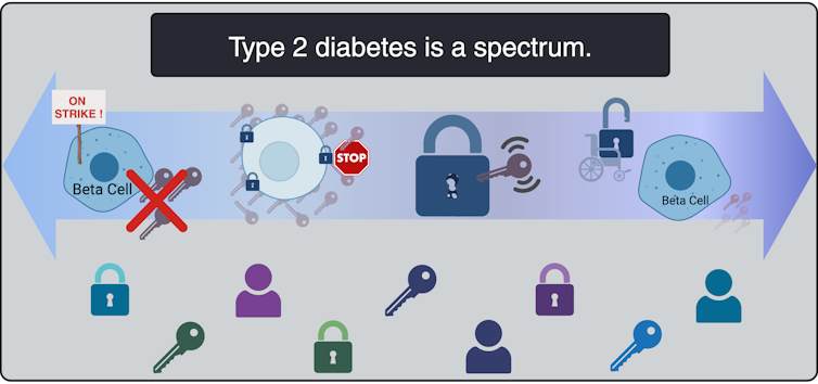 An example of the different subtypes of type 2 diabetes