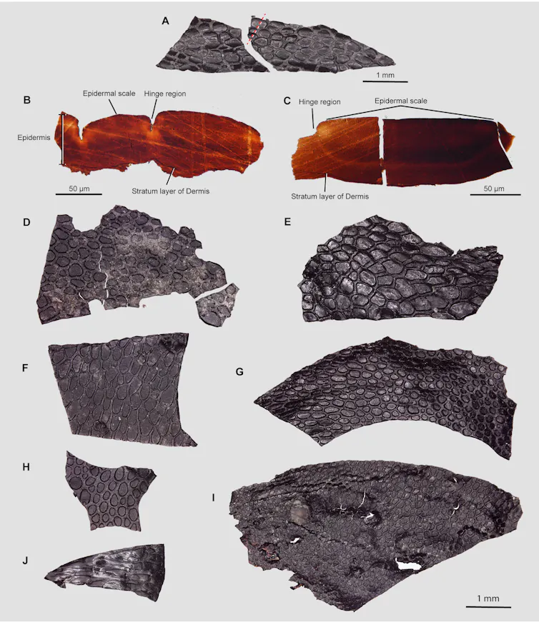 samples of skin casts
