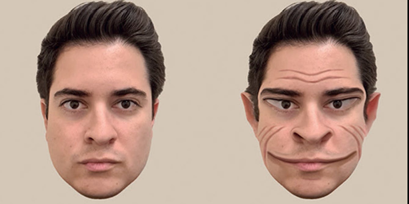 A rare condition makes other people’s faces look distorted. Why a new case is important