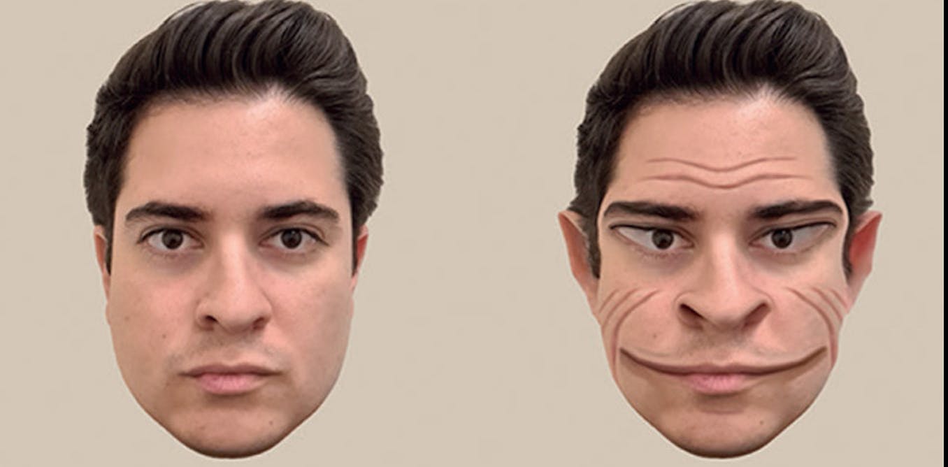 A rare condition makes other people’s faces look distorted. Why a new ...