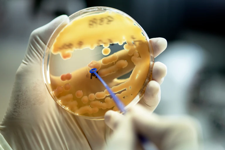 A scientist holds an agar plate where colonoies of Klebsiella pneumoniae have been grown.