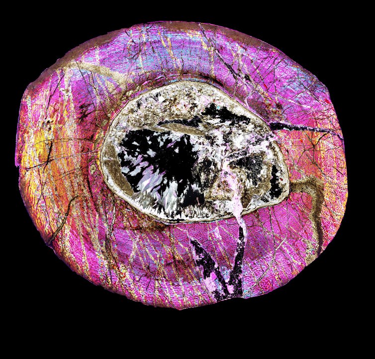 Microscopic image of a crosssection of bone tissue with many details present.