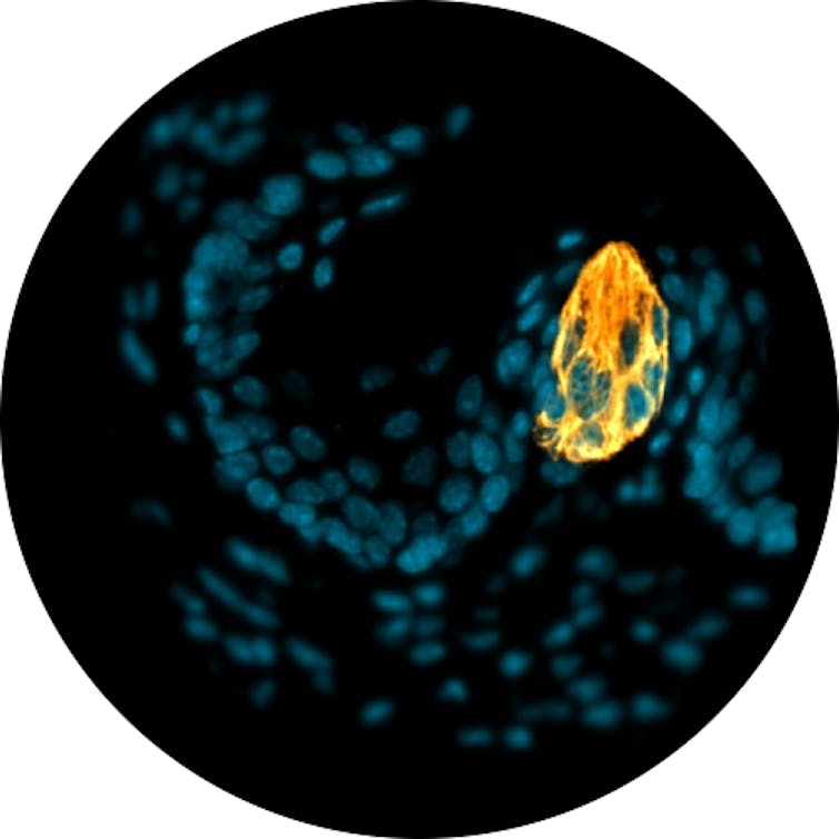 Photo ronde. Sur un fond noir, plusieurs points bleus représentent les cellules entourant le bourgeon, qui ressort en jaune