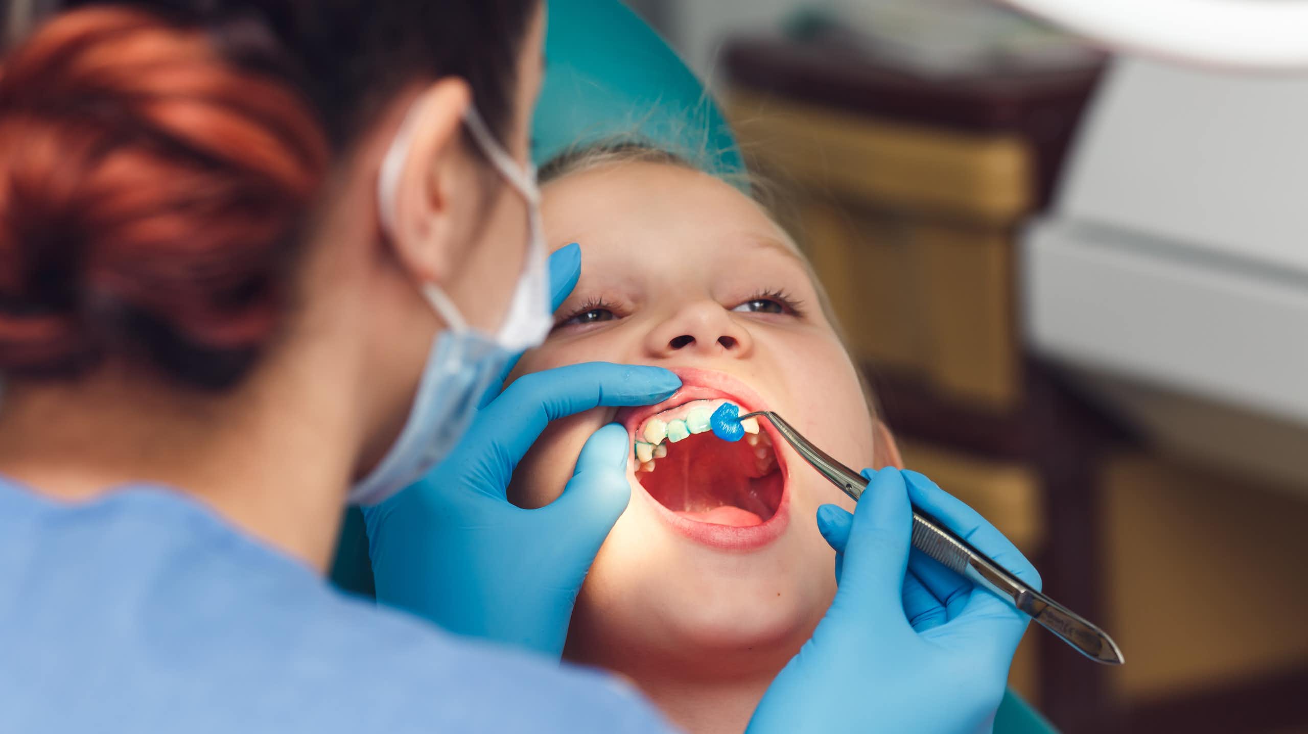 Las manchas en los dientes de los niños pueden revelar futuras caries y fracturas