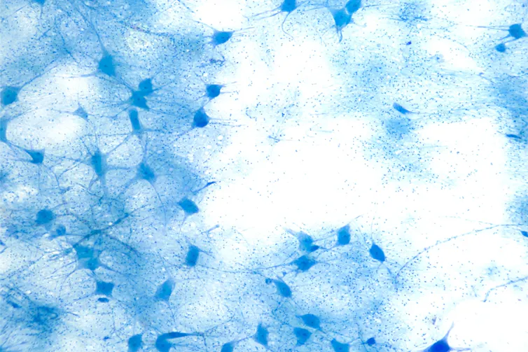 motor neurons under the microscope