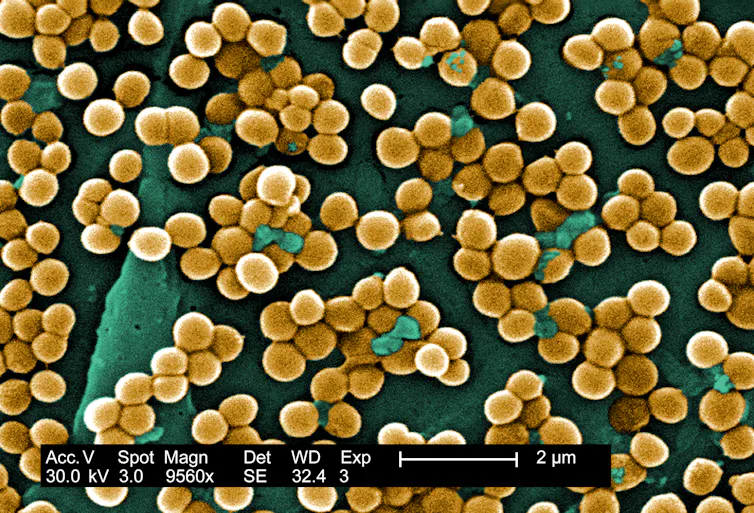 Image au microscope d’amas de bactéries sphériques colorées en jaune sur fond vert