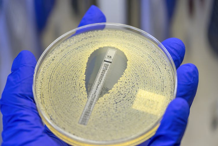 Gloved hand holding petri dish entirely covered by a film of bacteria except for a small area around a plastic strip