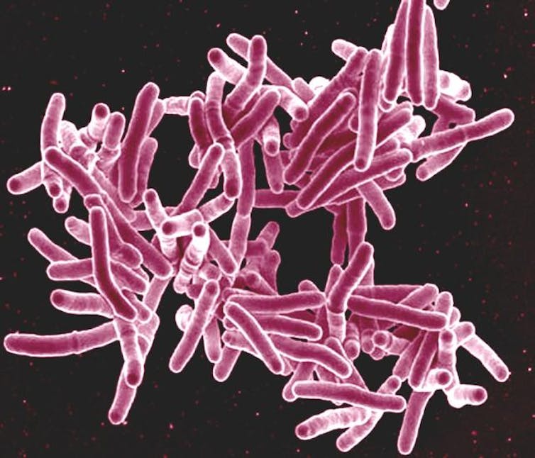 Microscopy image of a collection of rod-shaped bacteria, colored pink