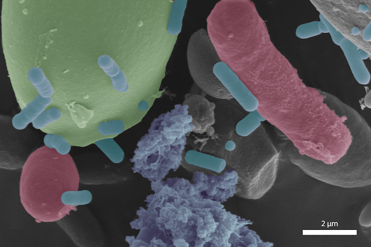 Imagen microscópica de bacterias en forma de bastón, levaduras alargadas y esféricas y granos de almidón globulares.