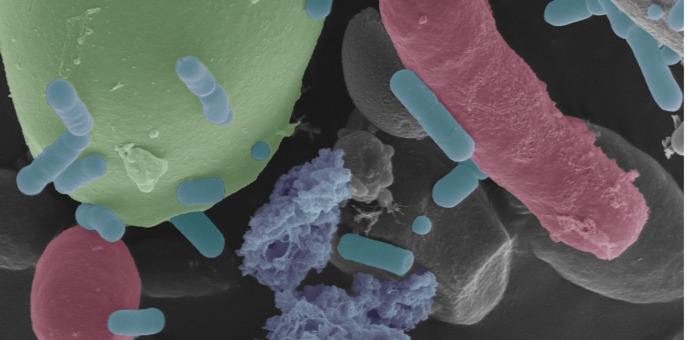 Sourdough under the microscope reveals microbes cultivated over generations