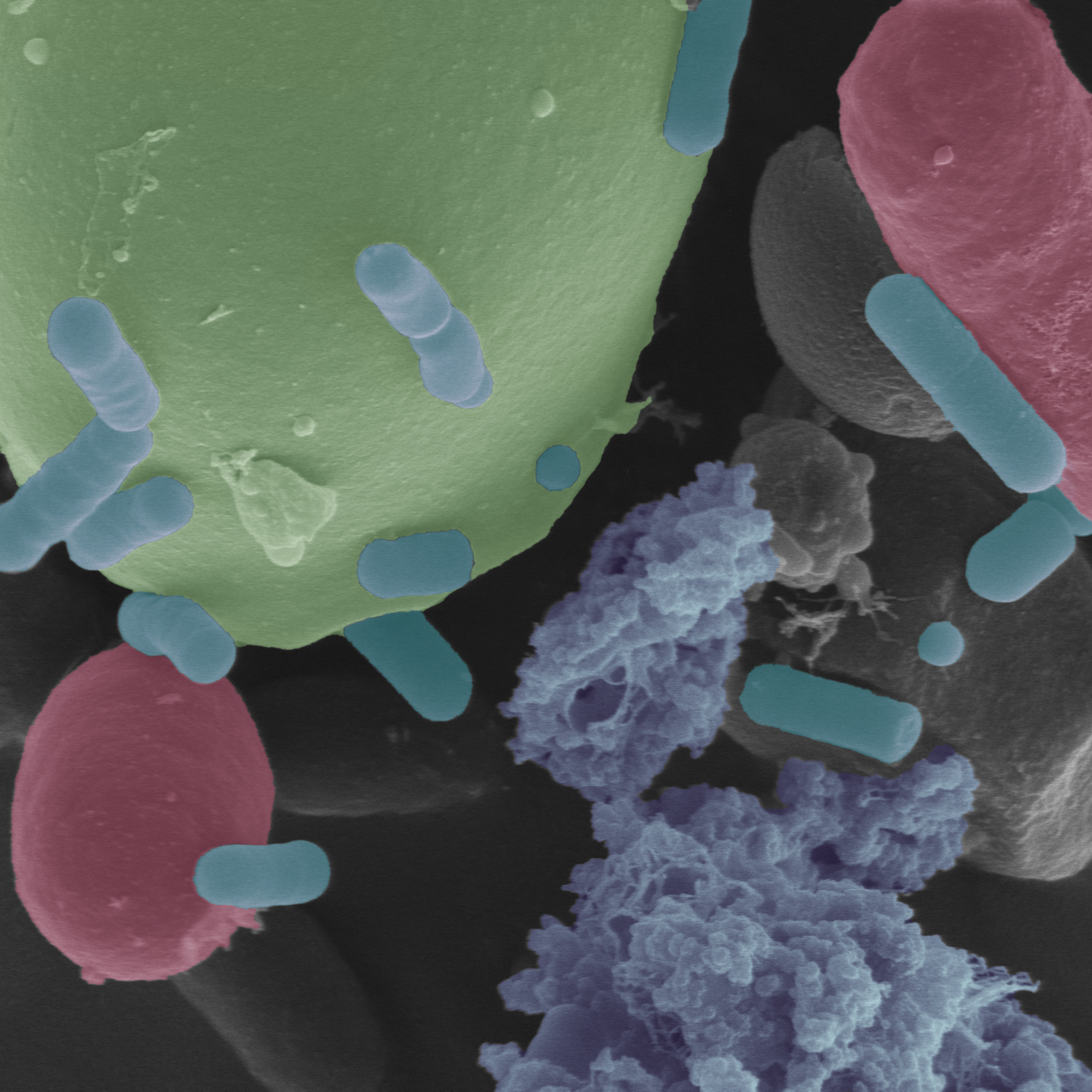 Microscopy image of rod-shaped bacteria, elongated and spherical yeast, and globular starch grains.