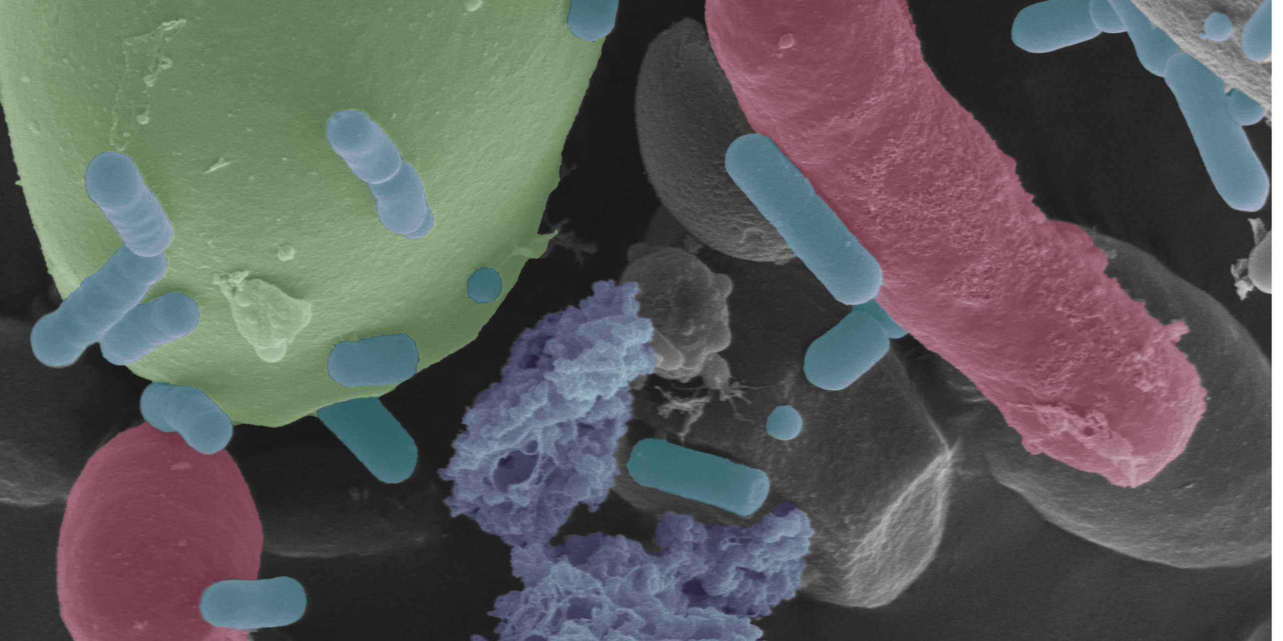 Microscopy image of rod-shaped bacteria, elongated and spherical yeast, and globular starch grains.