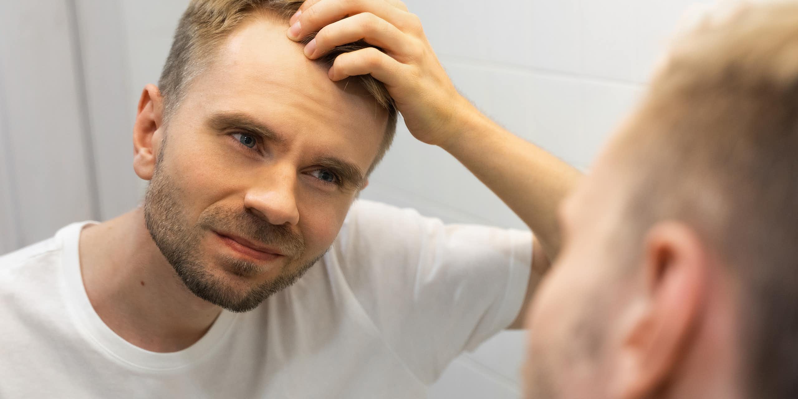 Male baldness is often trivialised – our research shows it should be taken seriously