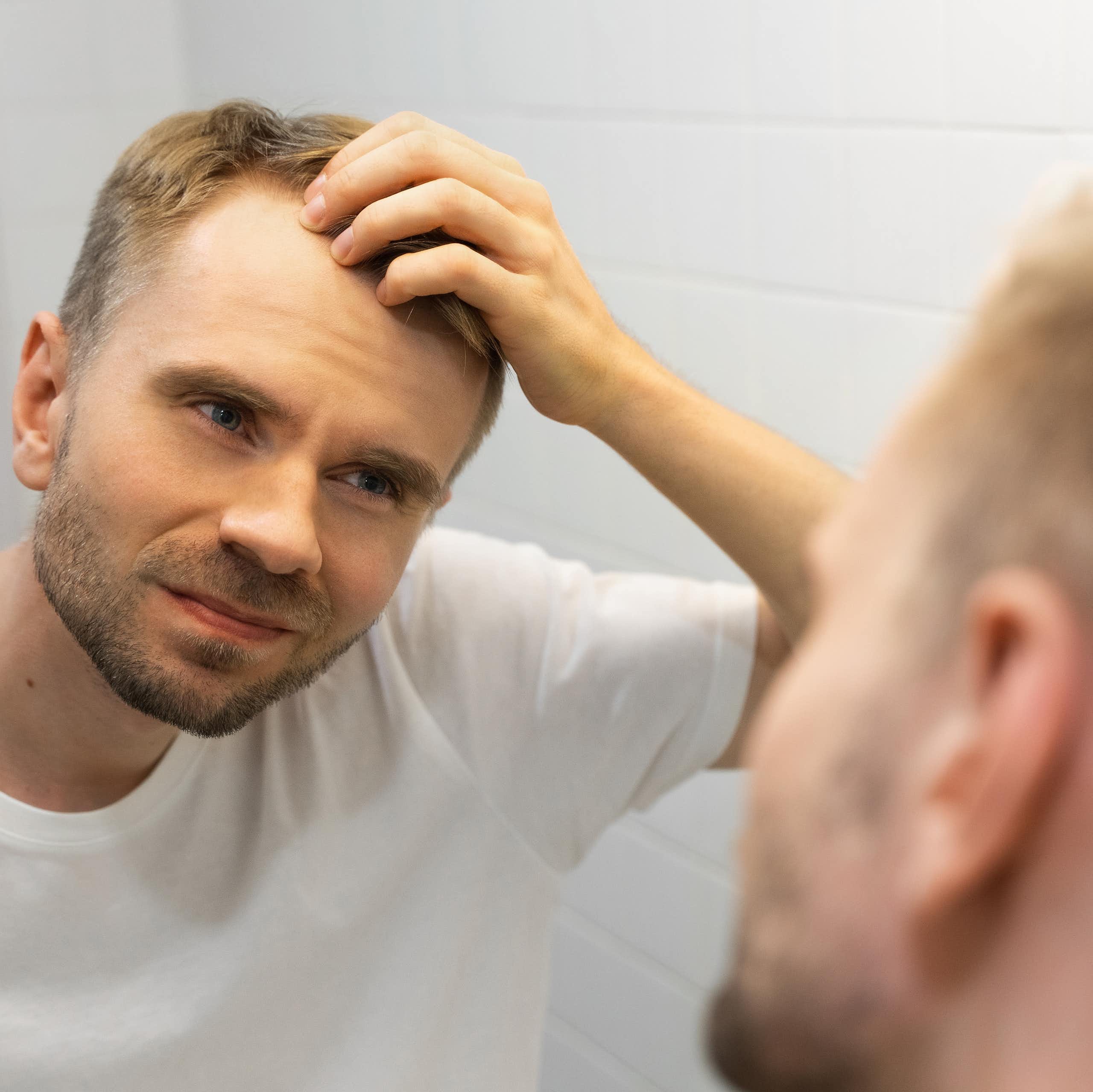 Male baldness is often trivialised – our research shows it should be taken seriously