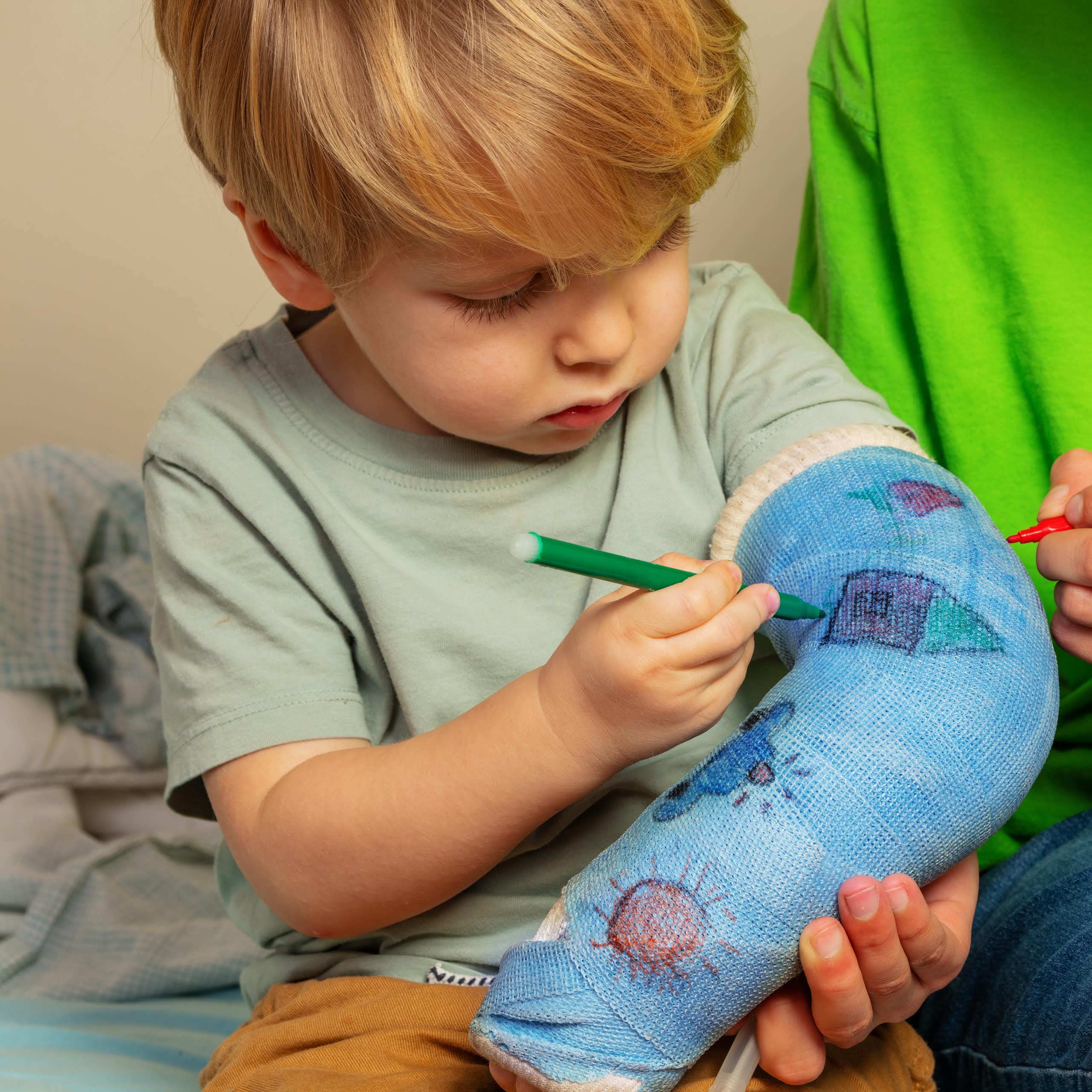 Boy with brother draw broken hand plaster cast painting childish drawings using felt-tip pen