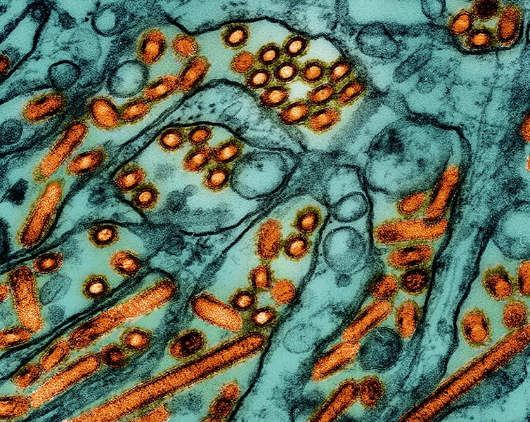 A colourized blue and orange microscopic image of a virus