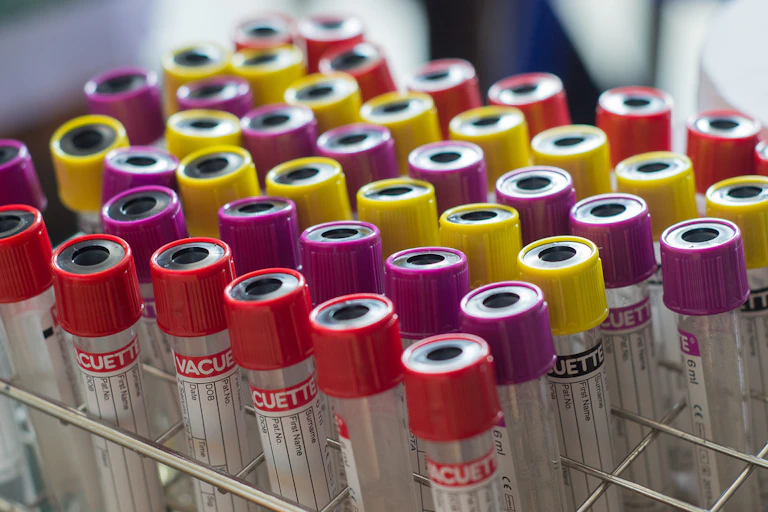 Rows of blood sample tubes in a rack