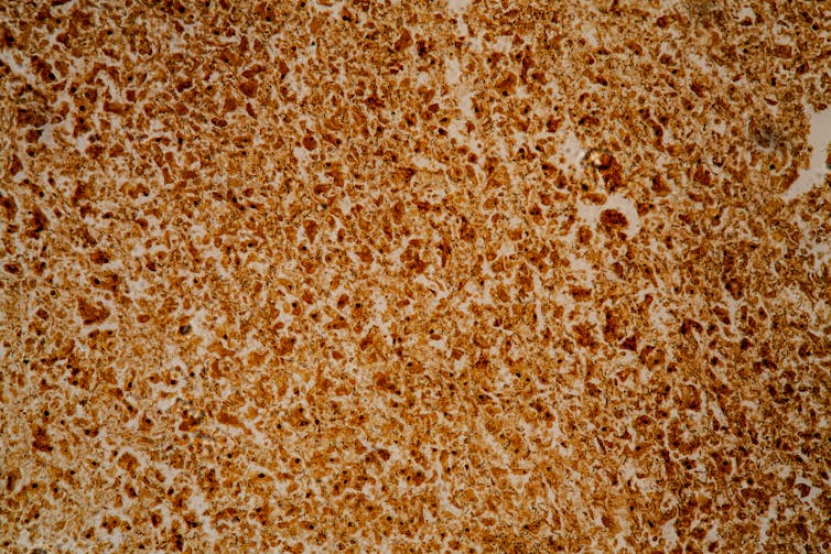 cells with brown colour