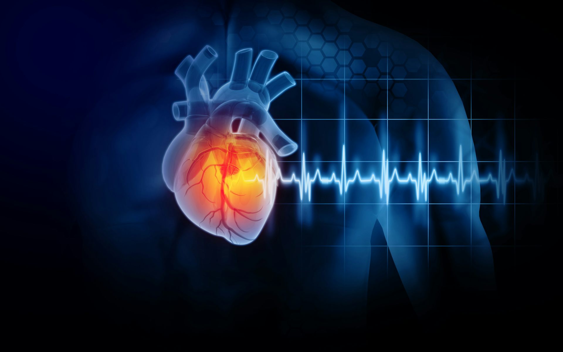 Llegan los primeros bioimplantes para pacientes con infarto de miocardio