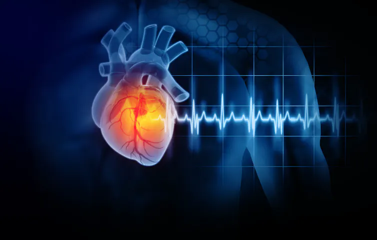 Llegan los primeros bioimplantes para pacientes con infarto de miocardio Llegan los primeros bioimplantes para pacientes con infarto de miocardio