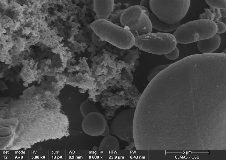 Imagen de microscopía de bacterias en forma de bastón, levaduras alargadas y esféricas y granos de almidón globulares.