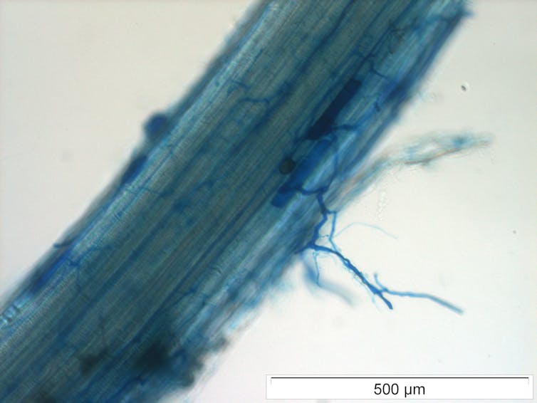 A section of rice plant root with mycorrhizal fungal threads as seen under a microscope
