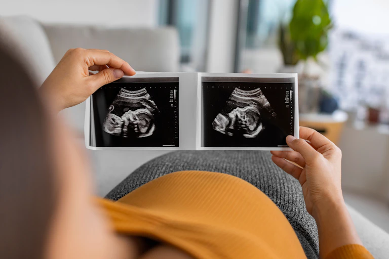 Person looking at ultrasound scans of their baby