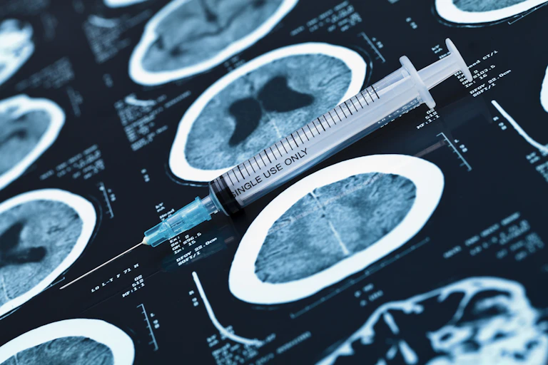 Sygrine lying on top of X-ray images of brain