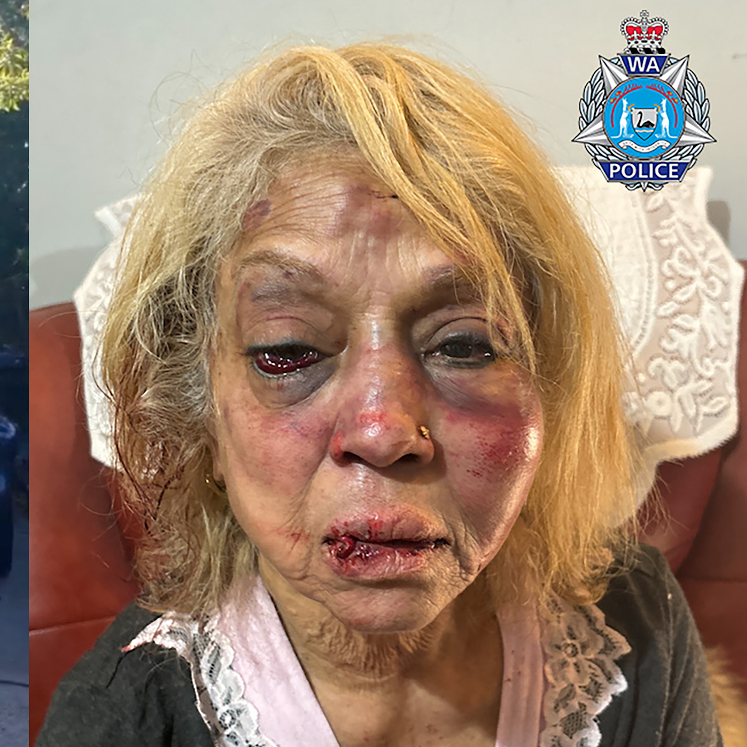 Grattan on Friday: O'Neil and Giles dodge the spotlight shining on blunders over ex-detainees