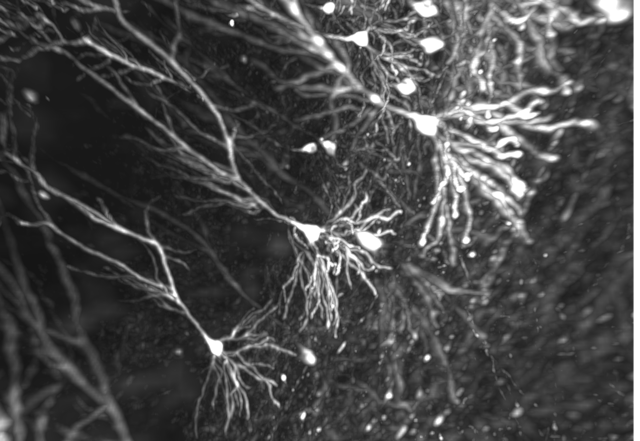 Photo par microscope en noir et blanc de neurones, avec leurs prolongements (axones et dendrites)