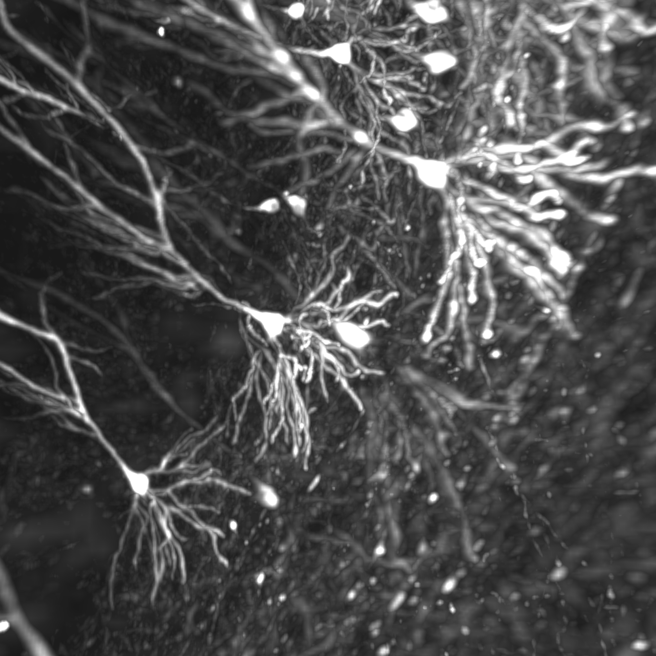 Photo par microscope en noir et blanc de neurones, avec leurs prolongements (axones et dendrites)