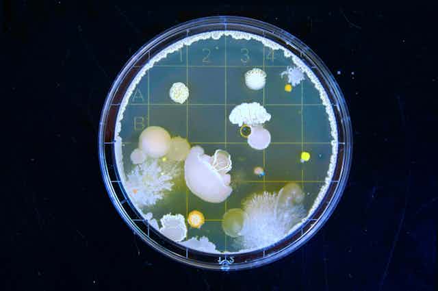 Photo of a Petri dish filled with bacterial blooms.