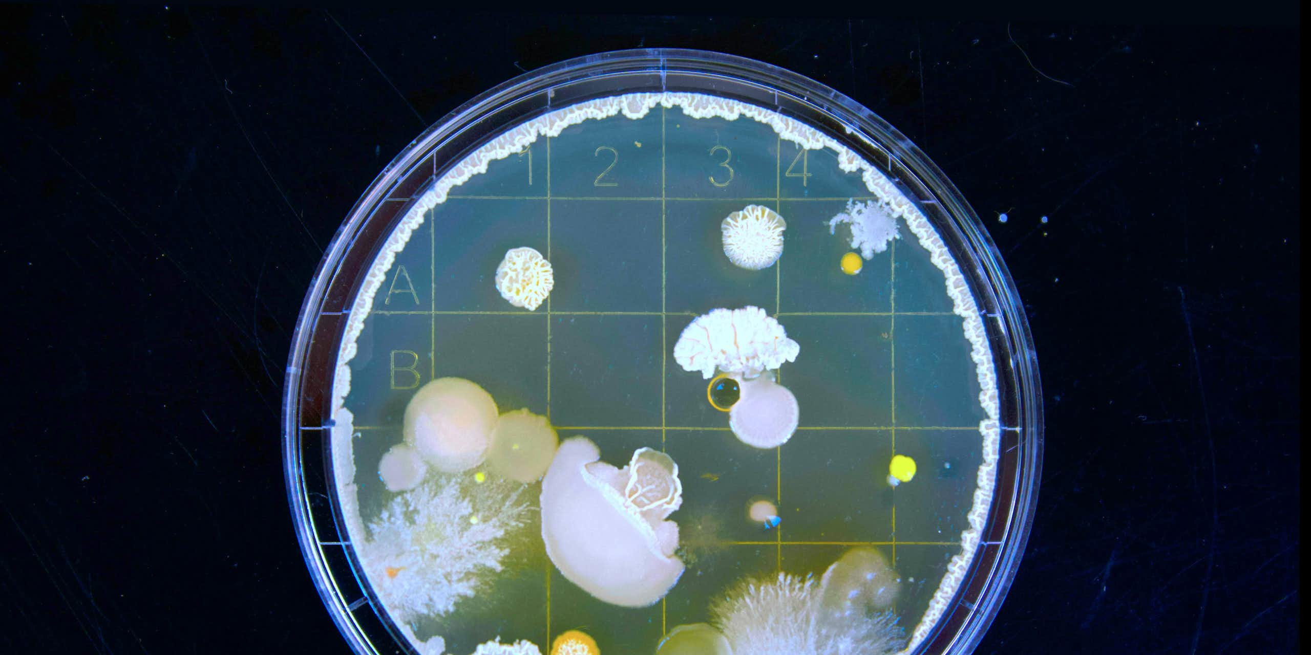 Photo of a Petri dish filled with bacterial blooms.