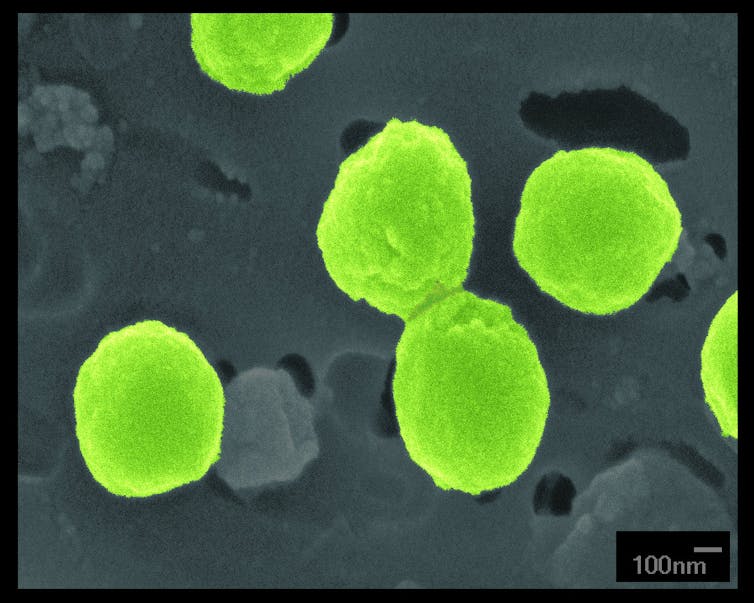 Microscopy image of spherical bacteria colored bright green
