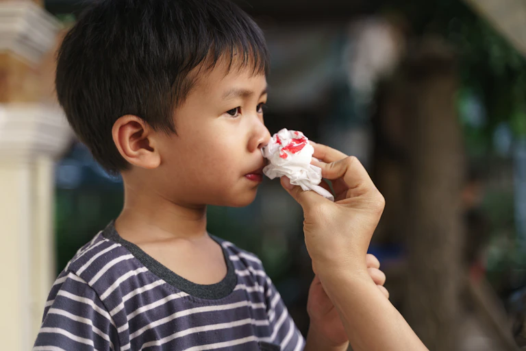 An adult's hand holds a tissue up to a boy's blood nose.