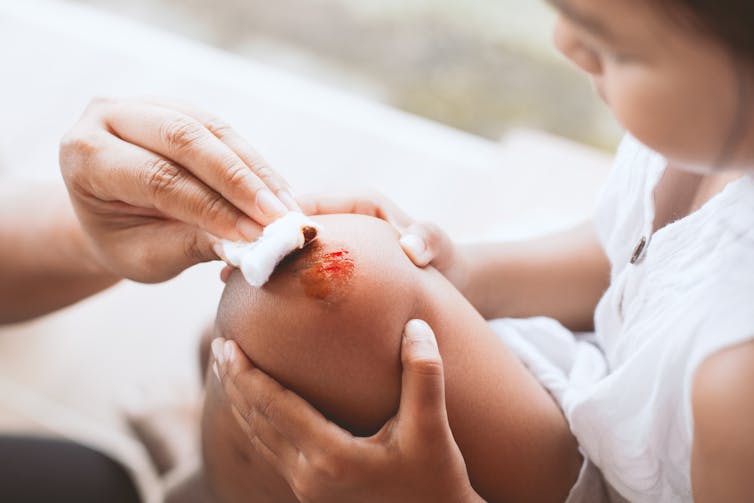 A child holding their scraped knee, while an adult cleans the blood with a white pad.