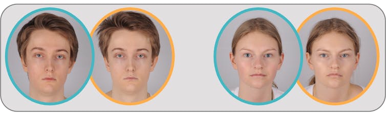 Participants photographed both after taking saline, a control substance and after receiving a lipopolysaccharide injection.