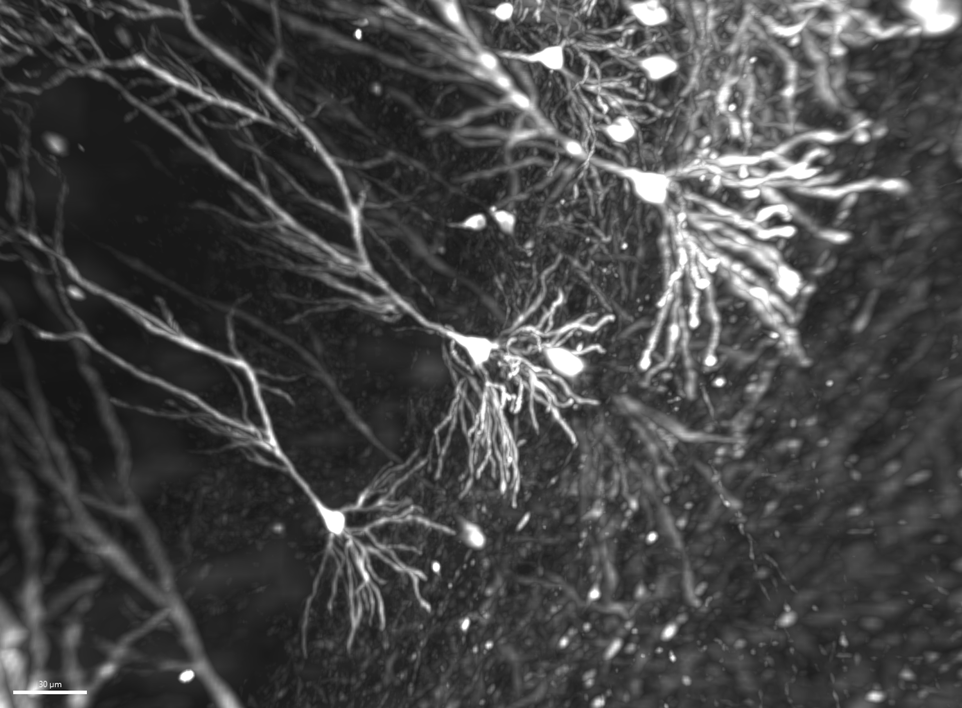 Como as memórias são armazenadas em nosso cérebro?, image size:1356x668