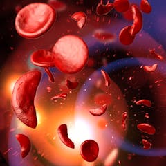 research topics on sickle cell anemia