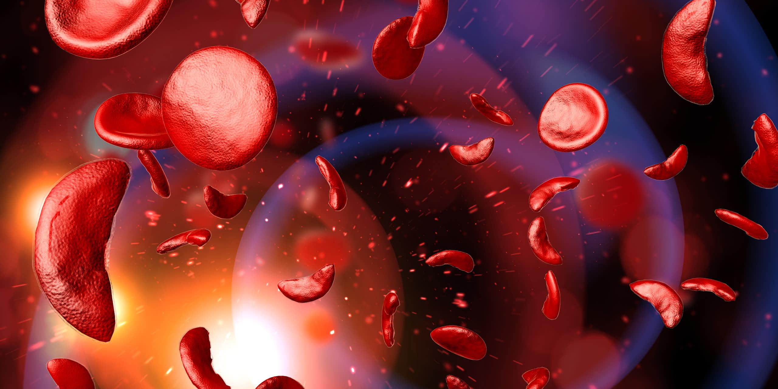 A digital drawing depicting the sickle shape red blood cells have in people with sickle cell disease.